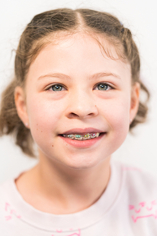Why Early Orthodontic Treatment is Important: A Parent’s Guide
